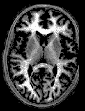 brain_segmentation.gif