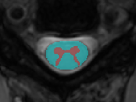 spinal_cord.png