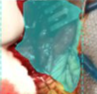 surgery.png